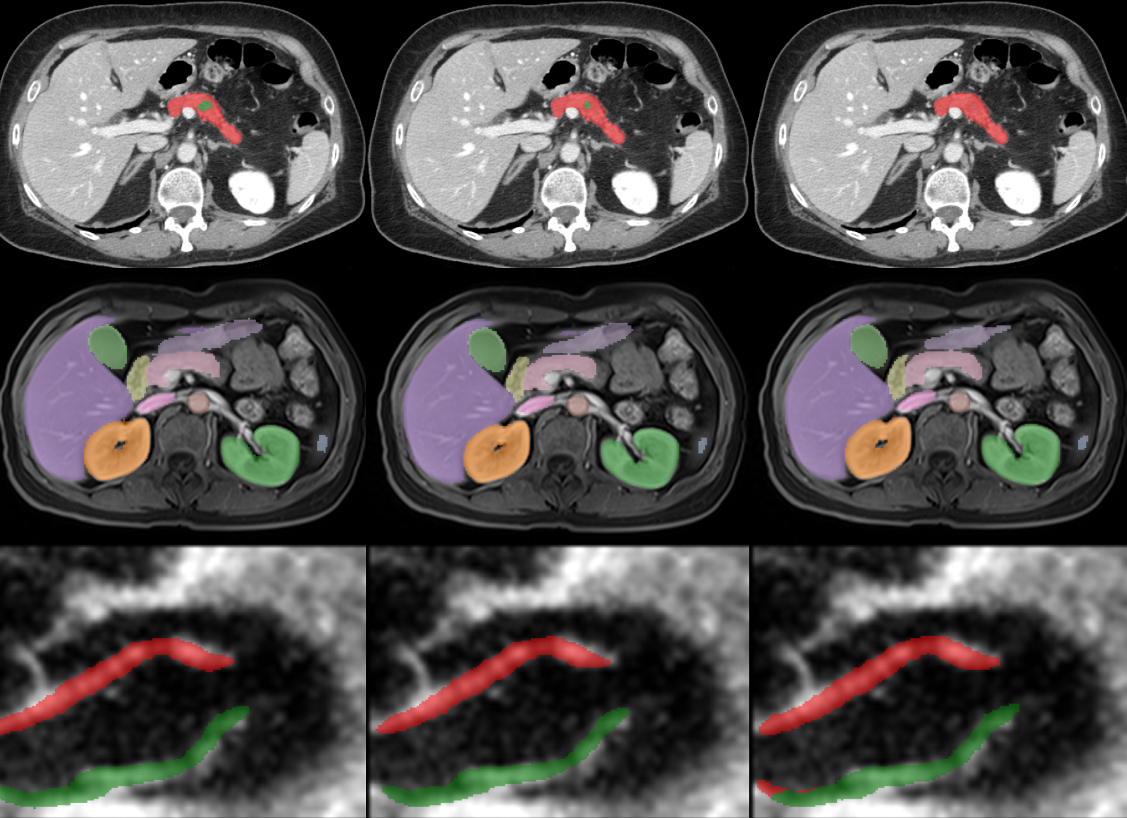 Mamba Goes HoME: Hierarchical Soft Mixture-of-Experts for 3D Medical Image Segmentation